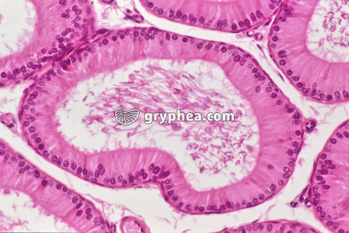 Epididyme x100 - gryphea.com